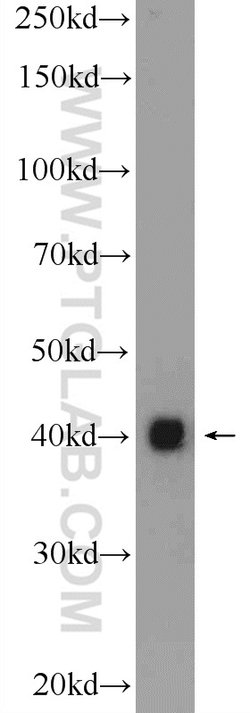 PUS1 Rabbit anti-Human, Mouse, Rat, Polyclonal, Proteintech:Antibodies:Primary