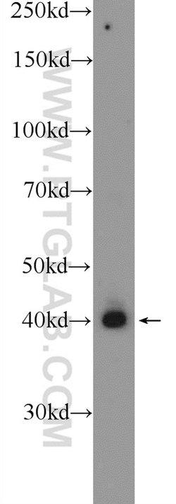 PUS1 Rabbit anti-Human, Mouse, Rat, Polyclonal, Proteintech:Antibodies:Primary