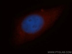 NCAPH Rabbit anti-Human, Mouse, Rat, Polyclonal, Proteintech 150 &mu;L;