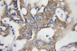 NCAPH Rabbit anti-Human, Mouse, Rat, Polyclonal, Proteintech 150 &mu;L;