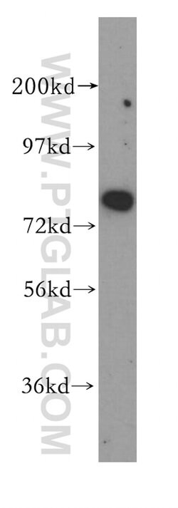 NCAPH Rabbit anti-Human, Mouse, Rat, Polyclonal, Proteintech 150 &mu;L;