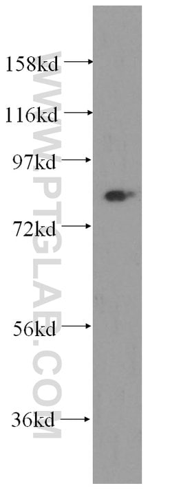NCAPH Rabbit anti-Human, Mouse, Rat, Polyclonal, Proteintech 150 &mu;L;