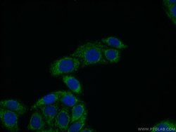 ECM1 Rabbit anti-Human, Mouse, Rat, Polyclonal, Proteintech:Antibodies:Primary