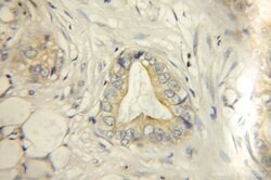 ECM1 Rabbit anti-Human, Mouse, Rat, Polyclonal, Proteintech:Antibodies:Primary