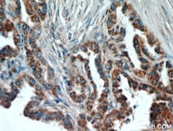 ECM1 Rabbit anti-Human, Mouse, Rat, Polyclonal, Proteintech:Antibodies:Primary
