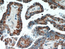 ECM1 Rabbit anti-Human, Mouse, Rat, Polyclonal, Proteintech:Antibodies:Primary