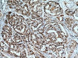 ECM1 Rabbit anti-Human, Mouse, Rat, Polyclonal, Proteintech:Antibodies:Primary