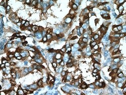 ECM1 Rabbit anti-Human, Mouse, Rat, Polyclonal, Proteintech:Antibodies:Primary