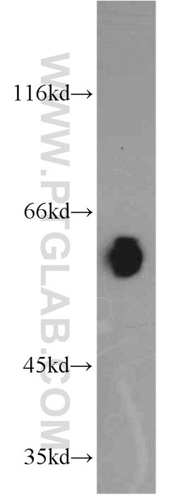 ECM1 Rabbit anti-Human, Mouse, Rat, Polyclonal, Proteintech:Antibodies:Primary