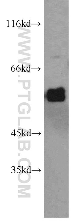 ECM1 Rabbit anti-Human, Mouse, Rat, Polyclonal, Proteintech:Antibodies:Primary