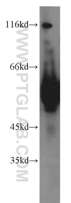 ECM1 Rabbit anti-Human, Mouse, Rat, Polyclonal, Proteintech:Antibodies:Primary