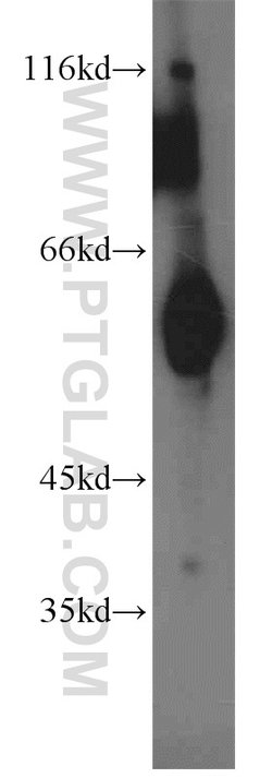 ECM1 Rabbit anti-Human, Mouse, Rat, Polyclonal, Proteintech:Antibodies:Primary