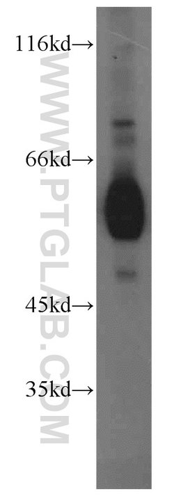 ECM1 Rabbit anti-Human, Mouse, Rat, Polyclonal, Proteintech:Antibodies:Primary