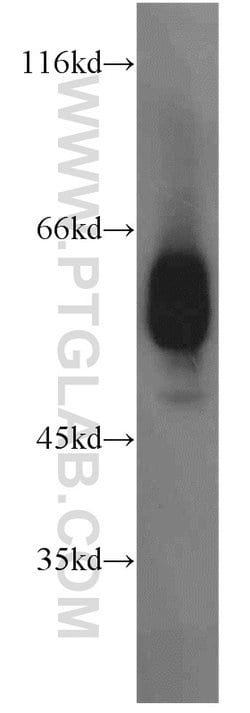 ECM1 Rabbit anti-Human, Mouse, Rat, Polyclonal, Proteintech:Antibodies:Primary