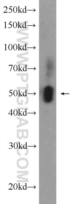 ECM1 Rabbit anti-Human, Mouse, Rat, Polyclonal, Proteintech:Antibodies:Primary
