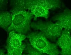 Cav beta Ca+2 Channel Monoclonal Antibody (S8b-1), QED Bioscience 100 &mu;g;