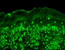 Cav beta Ca+2 Channel Monoclonal Antibody (S8b-1), QED Bioscience 100 &mu;g;