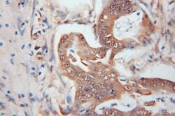 UCHL5 Rabbit anti-Human, Mouse, Rat, Polyclonal, Proteintech:Antibodies:Primary