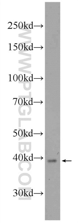 UCHL5 Rabbit anti-Human, Mouse, Rat, Polyclonal, Proteintech:Antibodies:Primary