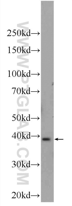 UCHL5 Rabbit anti-Human, Mouse, Rat, Polyclonal, Proteintech:Antibodies:Primary