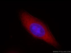 ASCC2 Rabbit anti-Human, Mouse, Rat, Polyclonal, Proteintech 150 &mu;L;