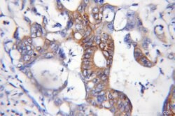 ASCC2 Rabbit anti-Human, Mouse, Rat, Polyclonal, Proteintech 150 &mu;L;