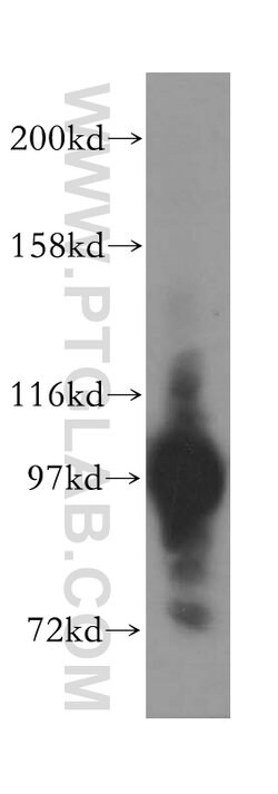 ASCC2 Rabbit anti-Human, Mouse, Rat, Polyclonal, Proteintech 150 &mu;L;