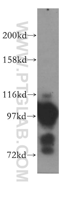 ASCC2 Rabbit anti-Human, Mouse, Rat, Polyclonal, Proteintech 150 &mu;L;