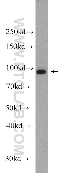 ASCC2 Rabbit anti-Human, Mouse, Rat, Polyclonal, Proteintech 150 &mu;L;