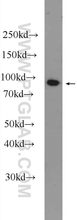 ASCC2 Rabbit anti-Human, Mouse, Rat, Polyclonal, Proteintech 150 &mu;L;