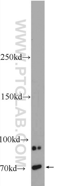 FBF1 Rabbit anti-Human, Mouse, Polyclonal, Proteintech:Antibodies:Primary