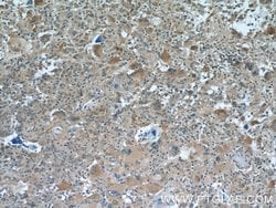 MAGED1 Rabbit anti-Human, Mouse, Rat, Polyclonal, Proteintech:Antibodies:Primary