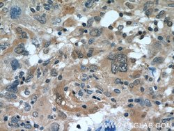 MAGED1 Rabbit anti-Human, Mouse, Rat, Polyclonal, Proteintech:Antibodies:Primary
