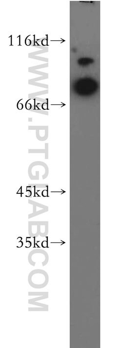 MAGED1 Rabbit anti-Human, Mouse, Rat, Polyclonal, Proteintech:Antibodies:Primary