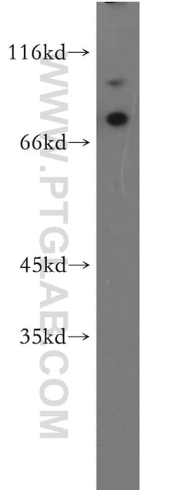 MAGED1 Rabbit anti-Human, Mouse, Rat, Polyclonal, Proteintech:Antibodies:Primary