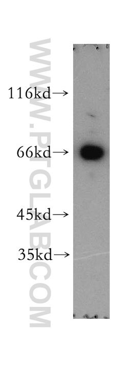 MAGED1 Rabbit anti-Human, Mouse, Rat, Polyclonal, Proteintech:Antibodies:Primary
