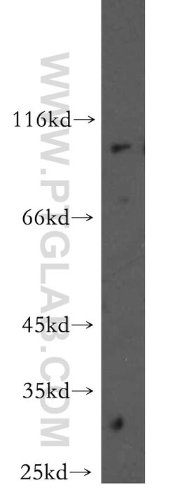 MAGED1 Rabbit anti-Human, Mouse, Rat, Polyclonal, Proteintech:Antibodies:Primary