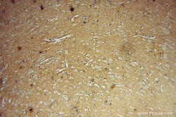 DGKA Rabbit anti-Human, Mouse, Rat, Polyclonal, Proteintech 150 &mu;L;
