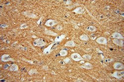 DGKA Rabbit anti-Human, Mouse, Rat, Polyclonal, Proteintech 150 &mu;L;