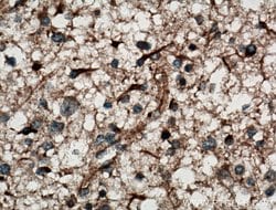 DGKA Rabbit anti-Human, Mouse, Rat, Polyclonal, Proteintech 150 &mu;L;