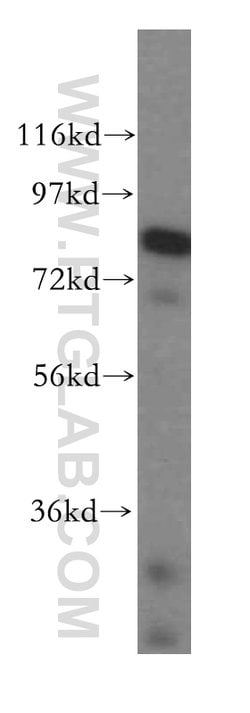 DGKA Rabbit anti-Human, Mouse, Rat, Polyclonal, Proteintech 150 &mu;L;