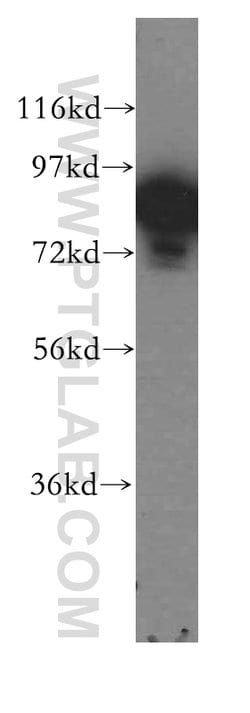 DGKA Rabbit anti-Human, Mouse, Rat, Polyclonal, Proteintech 150 &mu;L;