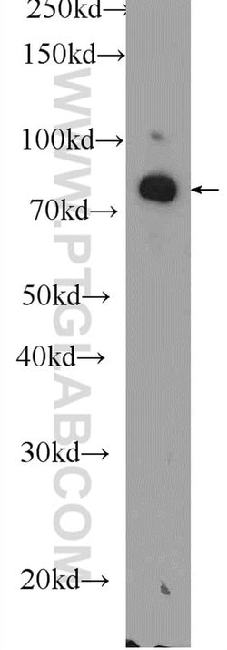 DGKA Rabbit anti-Human, Mouse, Rat, Polyclonal, Proteintech 150 &mu;L;