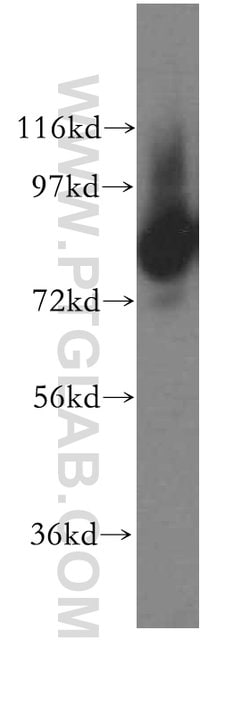 DGKA Rabbit anti-Human, Mouse, Rat, Polyclonal, Proteintech 150 &mu;L;