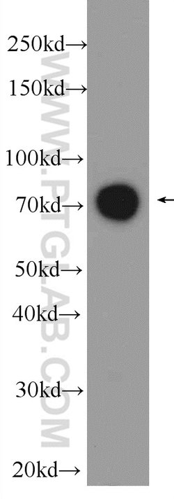 DGKA Rabbit anti-Human, Mouse, Rat, Polyclonal, Proteintech 150 &mu;L;