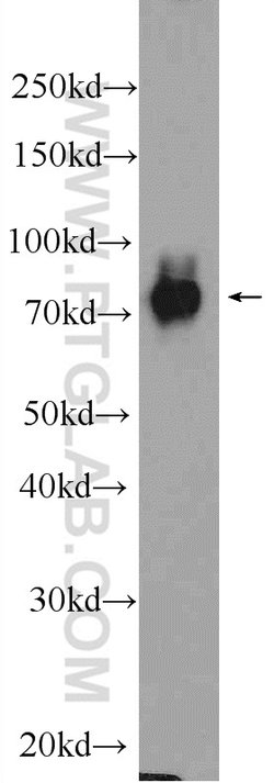 DGKA Rabbit anti-Human, Mouse, Rat, Polyclonal, Proteintech 150 &mu;L;