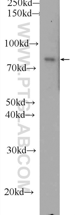 DGKA Rabbit anti-Human, Mouse, Rat, Polyclonal, Proteintech 150 &mu;L;