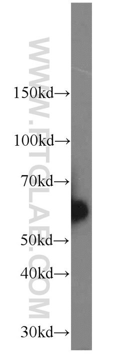 CAMKK2 Rabbit anti-Human, Mouse, Polyclonal, Proteintech:Antibodies:Primary