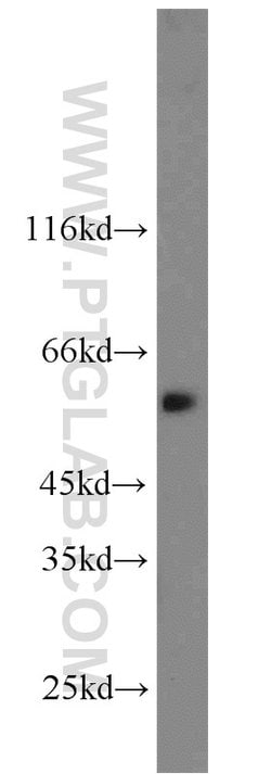 CAMKK2 Rabbit anti-Human, Mouse, Polyclonal, Proteintech:Antibodies:Primary
