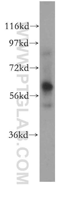 CAMKK2 Rabbit anti-Human, Mouse, Polyclonal, Proteintech:Antibodies:Primary